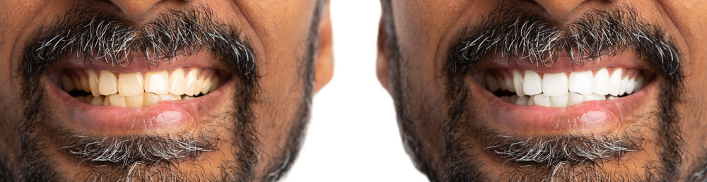 Cosmetic Dentistry