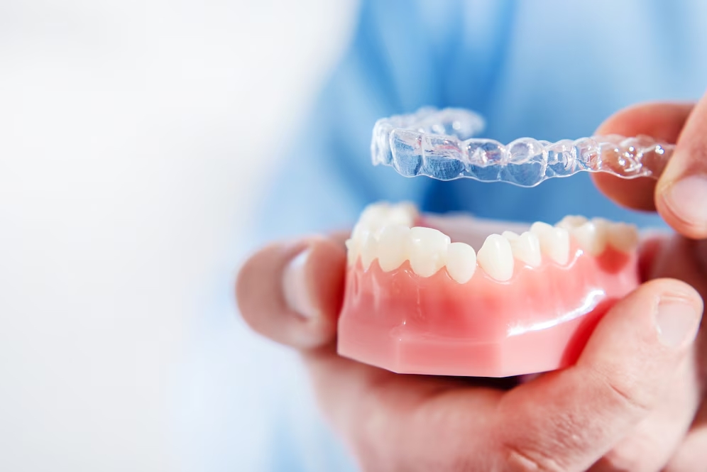 Is Invisalign Right for You? Clear Aligners in Casper